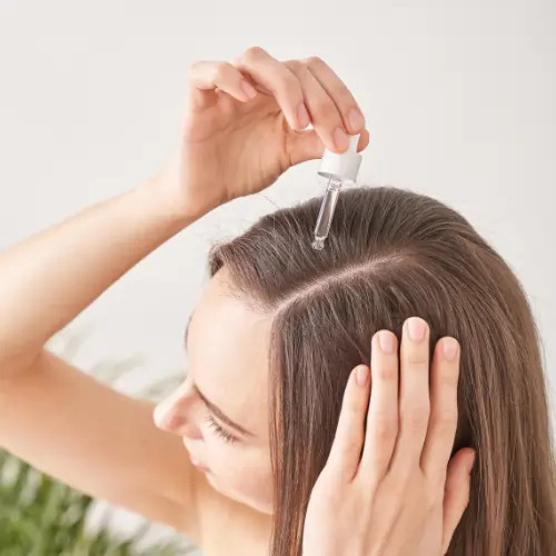 hair thinning due to PCOS